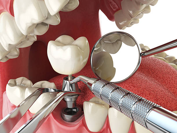 Best Pediatric Emergency Dentist in New Iberia, LA